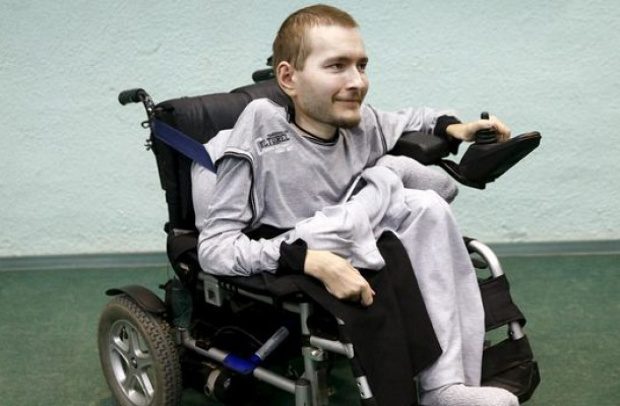 Megtörténik az első fejátültetés 2017-ben