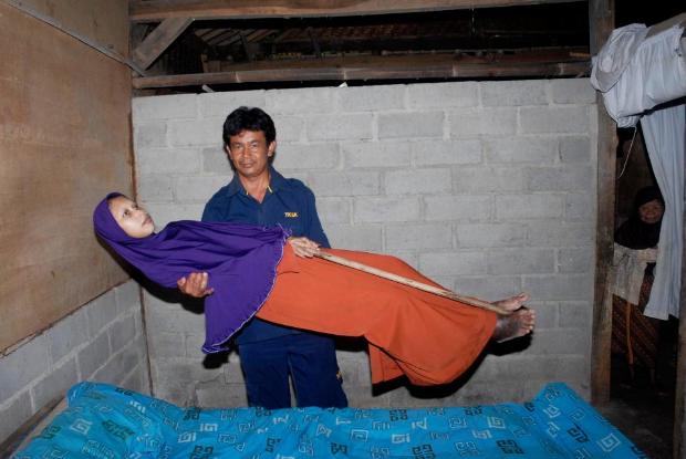 Sokkoló fotók a 10 éve kővé dermedt nő minden napjáról 1