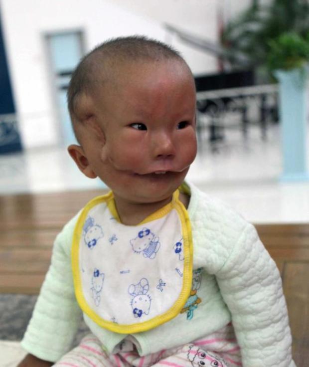 Szívbemarkoló szörnyű betegséggel született a kisfiú 2