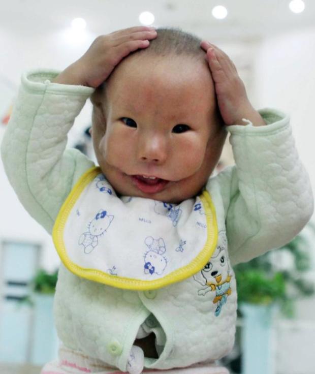 Szívbemarkoló szörnyű betegséggel született a kisfiú