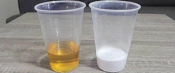 Fiú vagy lány? Megtudhatod leendő gyereked nemét ezzel az egyszerű szódabikarbónás teszttel