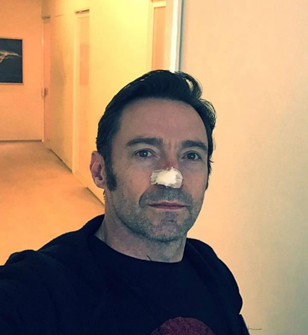 Kiújult Hugh Jackman rákja