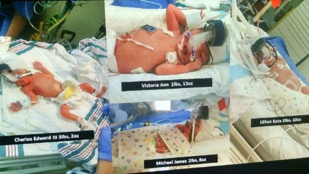 Négyes ikreket szült a rákos asszony 1