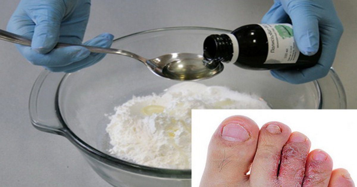 A ricinusolaj és a szódabikarbóna együttes hatása 20 betegség kezelésére alkalmas!