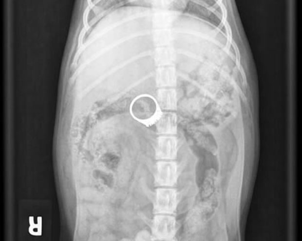 Elképesztő tárgyak az emberi testben Sokkoló röntgenelvételek! 1