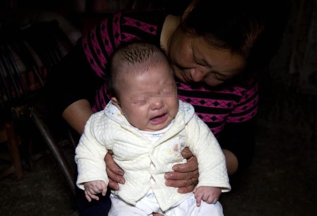 Megdöbbentek az orvosok, amikor meglátták a kisfiút 3