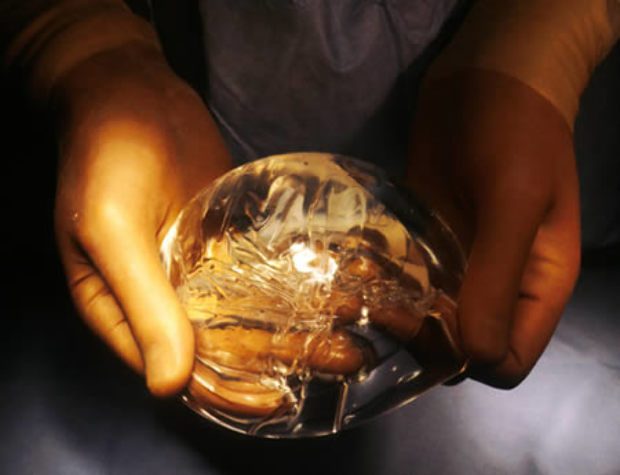 Megdöbbentő adattal álltak elő a tudósok ezt okozza a szilikon! 1