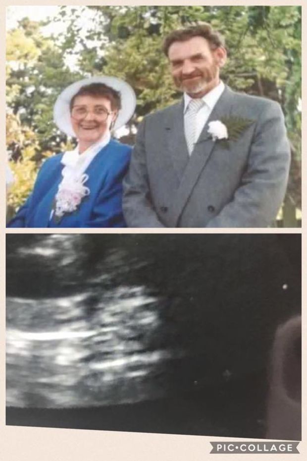 Sokkoló jelenség a terhességi ultrahangon, elsírta magát a kismama 1