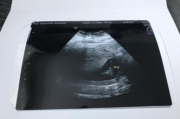 Sokkoló jelenség a terhességi ultrahangon, elsírta magát a kismama