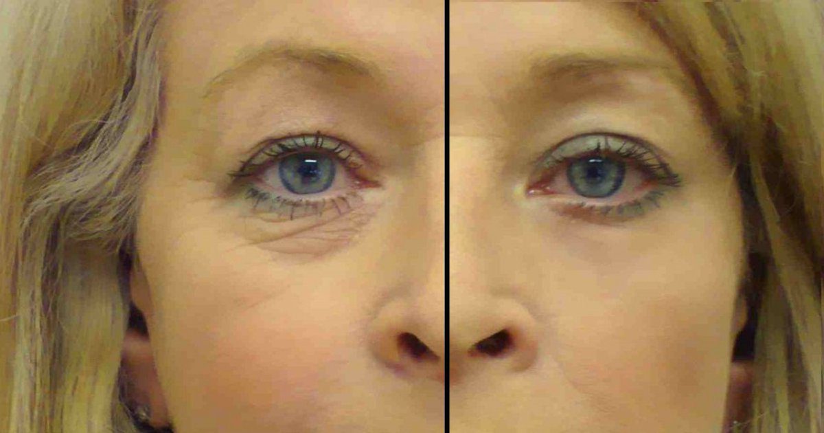 Szódabikarbónát tett a szeme alá! Pár perc múlva nem ismert magára!