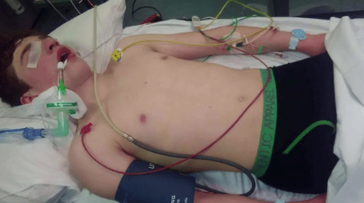 Megdöbbentő képeken mutatják meg a szülők, mit tett fiukkal az ecstasy