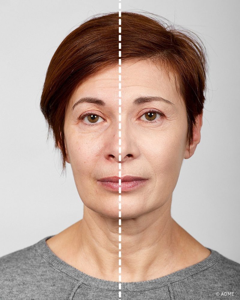 Ezzel a sminkkel éveket fiatalodhatsz! 7 tipp profiktól