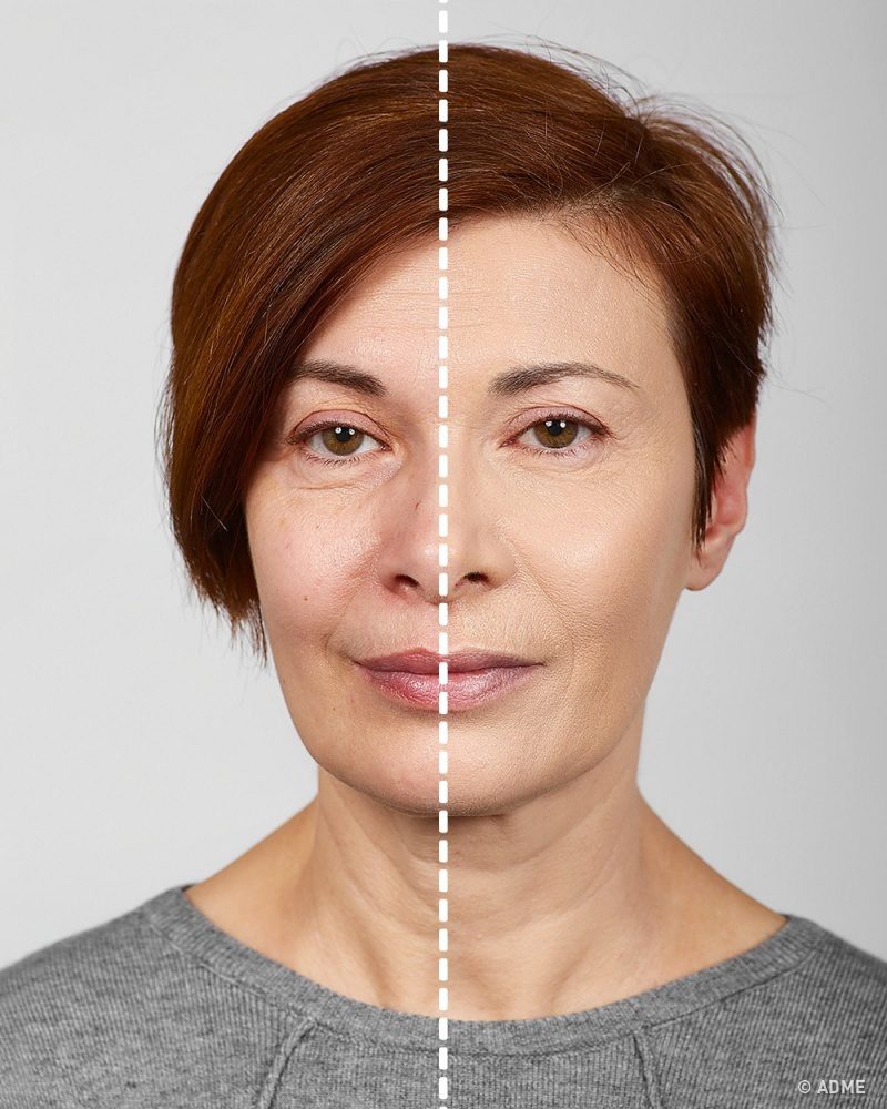 Ezzel a sminkkel éveket fiatalodhatsz! 7 tipp profiktól