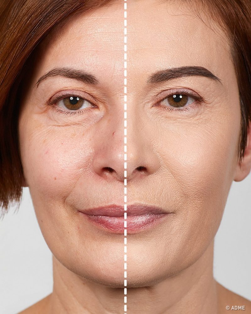 Ezzel a sminkkel éveket fiatalodhatsz! 7 tipp profiktól