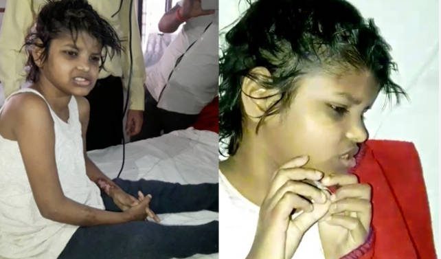 Majmok között élt az a 8 éves kislány, akit a dzsungelben találtak meg Indiában