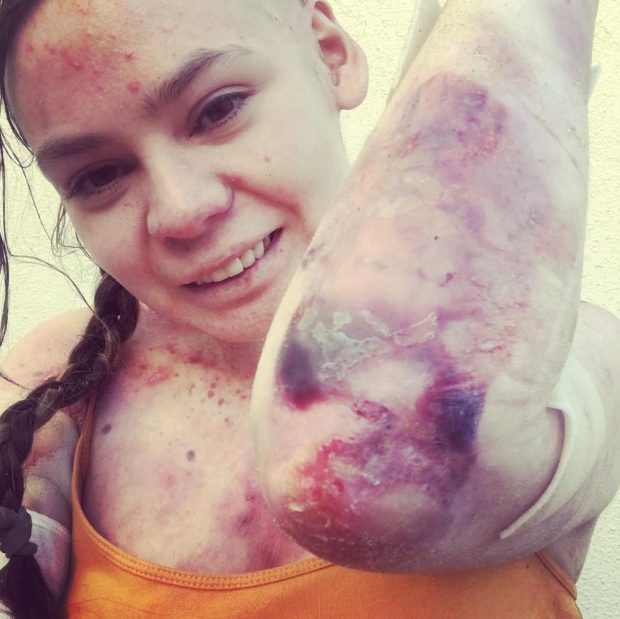 Minden mozdulat fáj a pillangólánynak 2