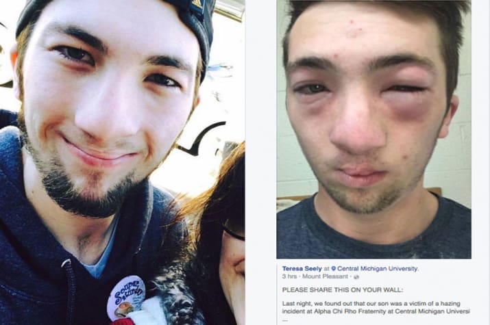 Mogyoróvajat kent allergiás diáktársa arcára, majdnem megölte vele