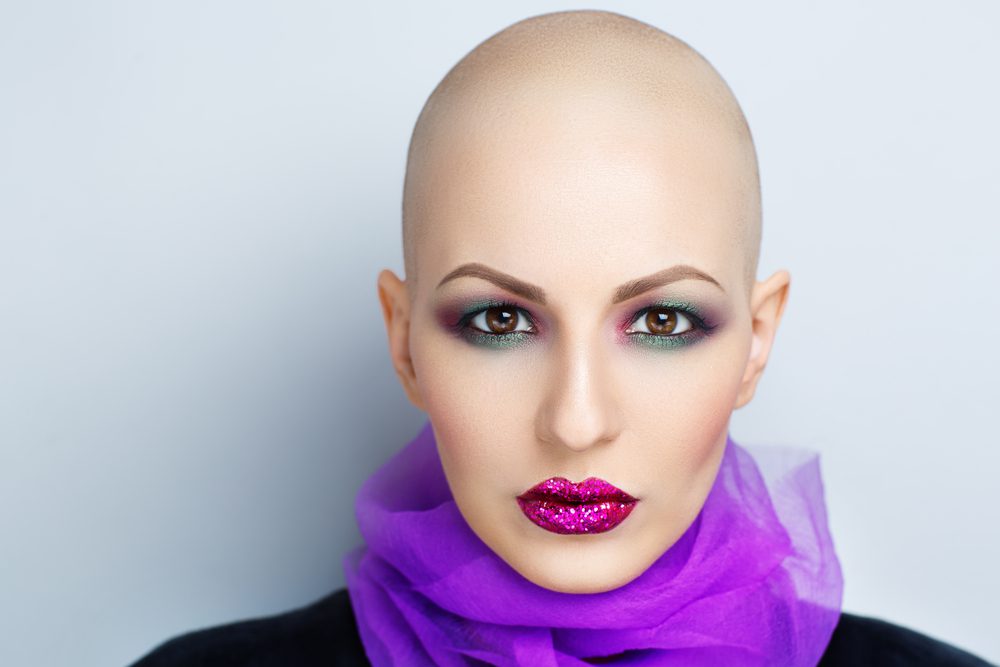 Van hatásos módszer kopaszodás ellen?