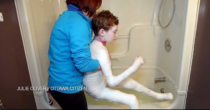 Az édesanya minden nap múmiát csinál a fiából… amikor megláttam, hogy miért, majd megszakadt a szívem… - VIDEÓ