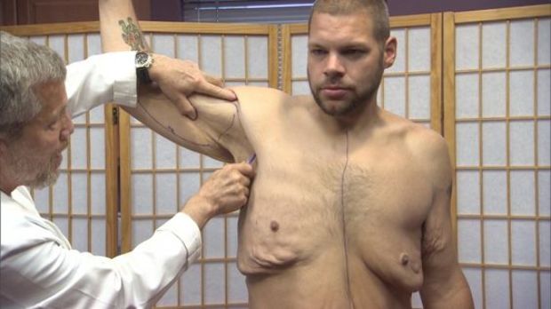 Elképesztő fogyás 262 kilótól szabadult meg a szerelmes fogyókúrázó pár 3