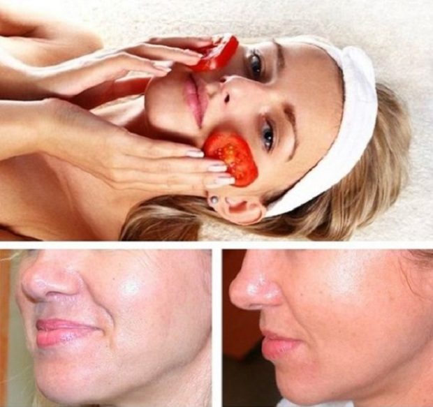 Elképesztő gyógyerő a paradicsomban! Tedd az arcodra, és csodát látsz 1