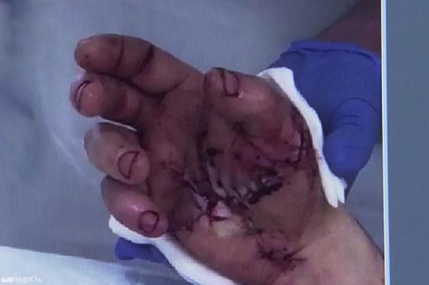 Rettenetes baleset ért egy magyar munkást Ausztriában 1