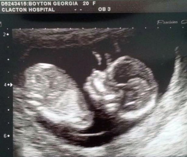 Ha hallgat az anyai ösztöneire, még most is élne a gyereke