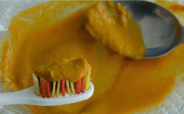 Elképesztő módszerrel lesz ragyogóan fehér a fogad 1