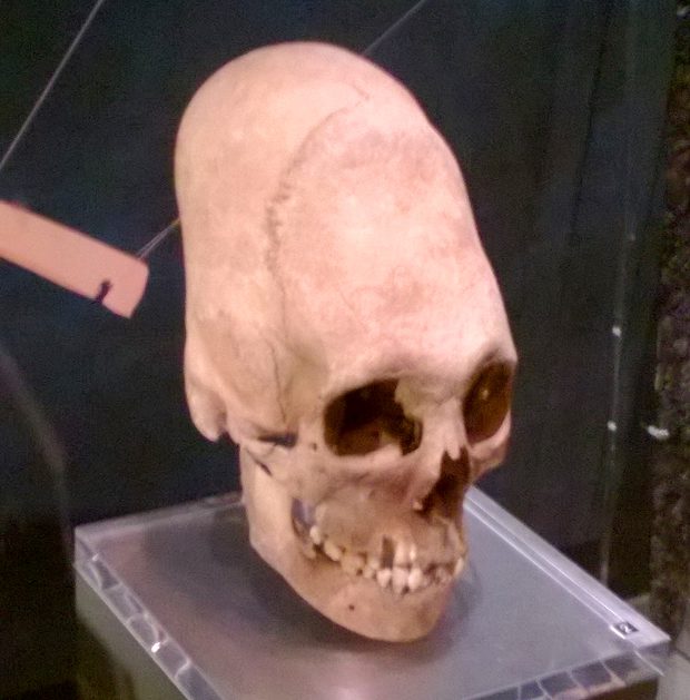 Minden végtagján csak három hosszú ujja van a rejtélyes perui múmiának - VIDEÓ 2