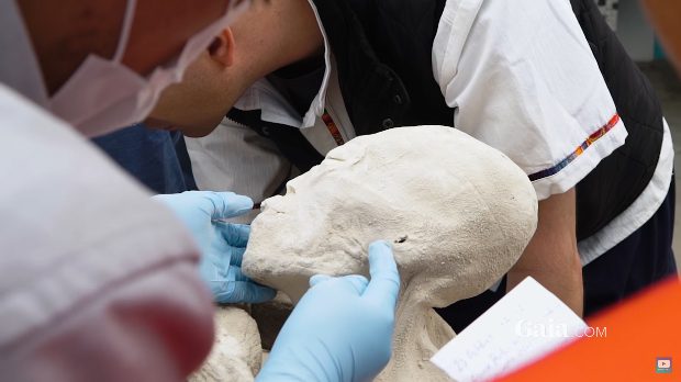 Minden végtagján csak három hosszú ujja van a rejtélyes perui múmiának - VIDEÓ 4