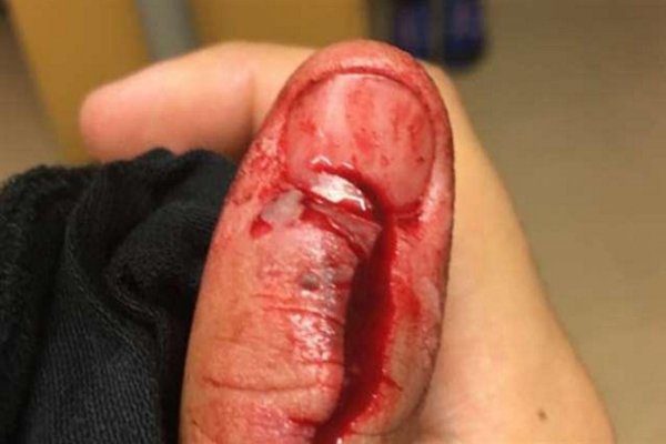 Figyelmeztetés! A népszerű játék felrobbant a kezében, erről neked is tudnod kell! 2